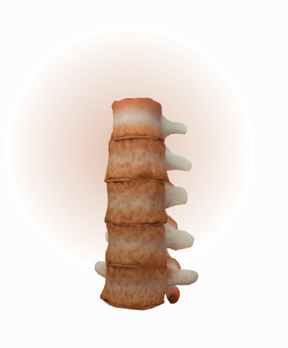 Inflammation is present, vertebrae affected throughout the spine and fused facet joints present in each segment (Reference 11)