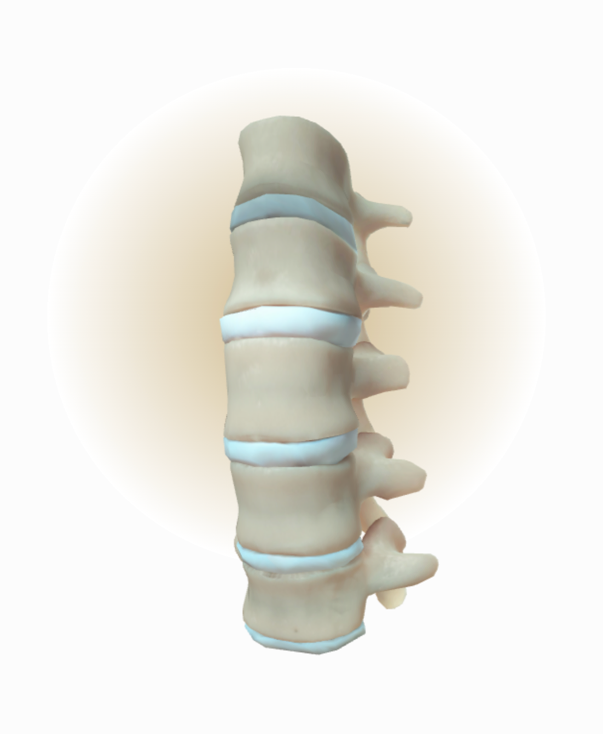 Skeletal changes in the spine for nr-axSpA