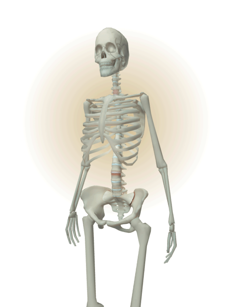 Skeletal depiction of the nr-axSpA
